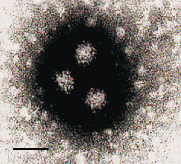 Electron microscopy showing NLV particles in a calf herd sample (CH176), negatively stained with 2% K-PTA, pH 7.0. Bar = 50nm.