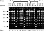 Thumbnail of Sample pulsed-field gel electrophoresis (PFGE) gel of representative Salmonella blockley isolates, indicating common and unique DNA fingerprints. Electrophoresis was through 1% agarose/0.5 x TBE, in a CHEF DRIII apparatus (BioRad Laboratories), at 14° C with a 120° switch angle and a run time of 20 hours, with a linear ramp of switching times from 5 to 32 seconds. Gels were stained with 0.5 mg/L ethidium bromide and documented under UV illumination by the EasyWin32 system (HeroLab,