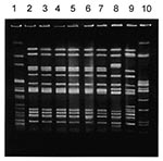 Thumbnail of Pulse-field gel electrophoresis patterns of Xba I-digested DNA of Salmonella Typhimurium strains. Lane 1, Xba I-digested S. Newport control strain am01144; lanes 2 through 4, S. Typhimurium strains isolated during the first, second, and third outbreaks in Georgia, respectively; lane 5, strain 00354 (Washington isolate); lane 6, strain 01587 (Washington isolate); lane 7, 9294-99 (Maryland isolate); lanes 8, 9, and 10, genetically unrelated control S. Typhimurium strains isolated in M