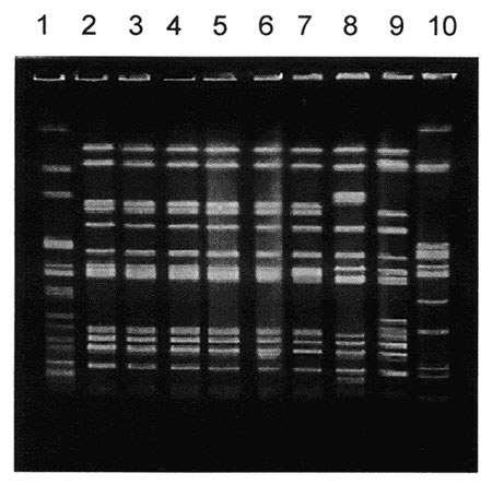 Pulse-field gel electrophoresis patterns of Xba I-digested DNA of Salmonella Typhimurium strains. Lane 1, Xba I-digested S. Newport control strain am01144; lanes 2 through 4, S. Typhimurium strains isolated during the first, second, and third outbreaks in Georgia, respectively; lane 5, strain 00354 (Washington isolate); lane 6, strain 01587 (Washington isolate); lane 7, 9294-99 (Maryland isolate); lanes 8, 9, and 10, genetically unrelated control S. Typhimurium strains isolated in Maryland, Wash