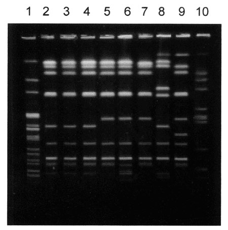 Pulse-field gel electrophoresis patterns of Avr II-digested DNA of Salmonella Typhimurium strains. Lane 1, S. Newport control strain am01144 (Xba I-digest); lanes 2 through 4, S. Typhimurium strains isolated during the first, second, and third outbreaks in Georgia, respectively; lane 5, strain 00354 (Washington isolate); lane 6, strain 01587 (Washington isolate); lane 7, 9294-99 (Maryland isolate); lanes 8, 9, and 10, genetically unrelated control S. Typhimurium strains isolated in Maryland, Was