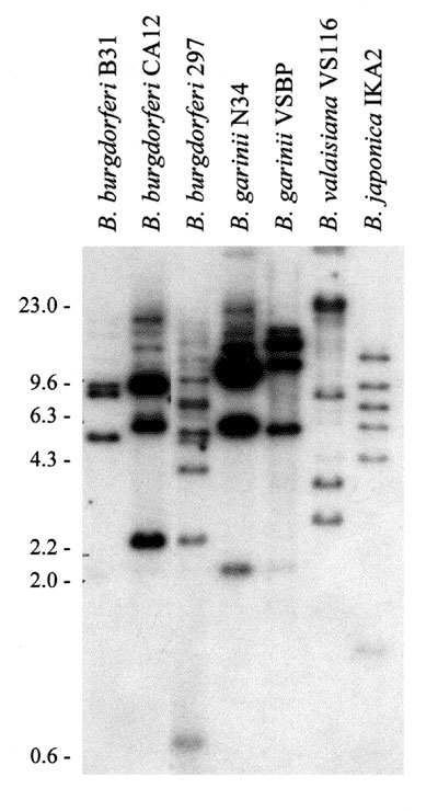 Restriction fragment length polymorphism pattern analysis of the rep or bdr genes of the Lyme disease spirochetes. Total DNA, isolated from Borrelia cultures, was digested with Xba1, fractionated by electrophoresis, and transferred onto membranes for hybridization. Hybridization was performed by the bdrAB-R1 oligonucleotide (46). The species and isolates analyzed are indicated above each lane. MW markers in kb are indicated.