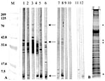 Thumbnail of Western blot reactivity to and Silver stain analysis of Mycobacterium ulcerans culture filtrates (MUCF). A) Representative antibody responses to MUCF. M; molecular weight markers with annotations corresponding to molecular weight on the left; lanes 1-6, representative BU patient sera with reactivity to MUCF; lanes 7-10, representative antibody reactivity in healthy persons from the disease-endemic area; lanes 11-12, serologic reactivities to MUCF of two representative tuberculosis (
