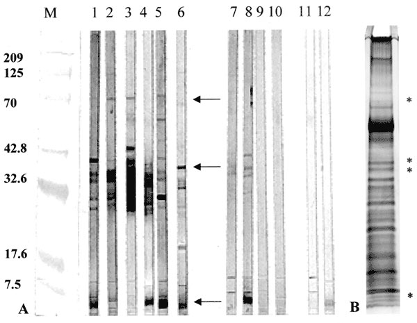 Western blot reactivity to and Silver stain analysis of Mycobacterium ulcerans culture filtrates (MUCF). A) Representative antibody responses to MUCF. M; molecular weight markers with annotations corresponding to molecular weight on the left; lanes 1-6, representative BU patient sera with reactivity to MUCF; lanes 7-10, representative antibody reactivity in healthy persons from the disease-endemic area; lanes 11-12, serologic reactivities to MUCF of two representative tuberculosis (TB) patients.