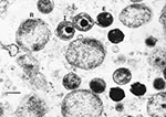 Thumbnail of Transmission electron micrograph of chlamydial particles in liver from a captive African clawed frog (Xenopus tropicalis). Note the reticulate bodies (R), intermediate bodies (I), and highly condensed elementary bodies (E). Bar, 270 nm.