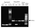 Thumbnail of Agarose gel electrophoresis of Rhinosporidium-specific PCR products. The specific amplification product is 377 bp. No amplification product is seen in the negative control samples consisting of water (reagent-only control), digestion buffer (DB), or lymph node tissue control (Tis Cnt). The human rhinosporidiosis samples (RS1-3) and the original canine nasal polyp show visible amplification products.
