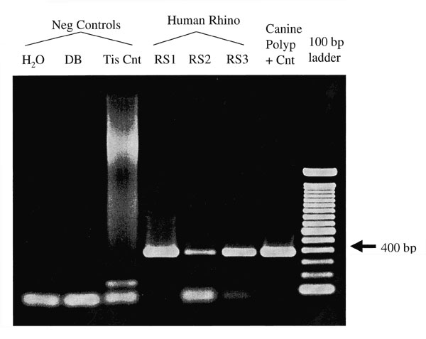 Agarose gel electrophoresis of Rhinosporidium-specific PCR products. The specific amplification product is 377 bp. No amplification product is seen in the negative control samples consisting of water (reagent-only control), digestion buffer (DB), or lymph node tissue control (Tis Cnt). The human rhinosporidiosis samples (RS1-3) and the original canine nasal polyp show visible amplification products.
