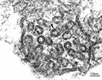 Thumbnail of Transmission electron micrograph of a mitochondrion from Rhinosporidium seeberi. The cristae of this mitochondrion (arrows) have tubulovesicular morphology. Magnification 195,000X.