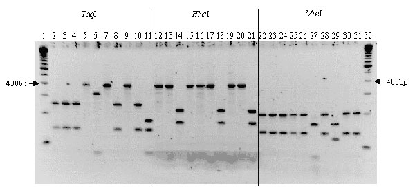 Polymerase chain reaction/restriction fragment length polymorphism of the citrate synthase gene of isolates from cattle, deer, and elk, with TaqI, HhaI, and MseI endonucleases. Lanes 1 and 32, standard 100-bp molecular ladder; lanes 2, 12, and 22, cattle isolate; lanes 3 to 7, 13 to 17, and 23 to 27, deer isolates; lanes 8 to 10, 18 to 20, and 28 to 30, elk isolates; lanes 11, 21, and 31, B. henselae strain.