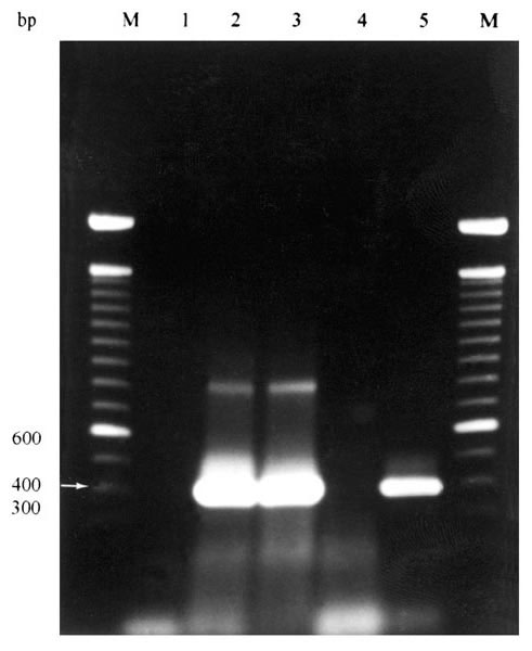 Agarose gel electrophoresis of results of PCR amplification of Ehrlichia chaffeensis nss rRNA gene from whole blood samples of coyotes numbers 9-11.* Lane 1= negative control (no DNA); Lane 2= coyote 9 (+); Lane 3= coyote 10 (+); Lane 4= coyote 11 (-); Lane 5 = positive control (E. chaffeensis-infected DH82 cells). M = 100-bp DNA ladder (Life Technologies, Rockville, MD).* * Ehrlichia forward primer ECC (5'-AGAACGAACGCTGGCGGCAAGC-3') and Ehrlichia reverse primer ECB (5'-CGTATTACCGCGGCTGCTGGCA-3'