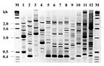 Thumbnail of Random amplified polymorphic DNA fingerprinting (RAPD) types generated by arbitrarily primed PCR. Lanes 5-8 show results for the four index strains of the atypical Chryseobacterium meningosepticum, 96, 97-1, 97-2, and 97-3, respectively; lanes 1-4, four clinical isolates of C. meningosepticum from Canada; lanes 9-10, two clinical isolates of B. cepacia; lane 11, P. aeruginosa strain P1; and lane 12, clinical isolate of K. pneumoniae. Lane M shows the 1-kb DNA ladder.
