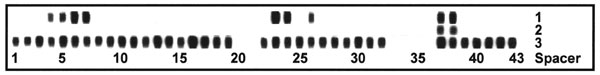 Spoligotype patterns of the isolates obtained from patient 1 (lane 1) and patient 2 (lane 2) and control strain H37Rv (lane 3).