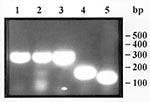 Thumbnail of Gel agarose electrophoresis of the polymerase chain reaction amplification products of Trichinella sp. larvae. Lines 1 and 2, larvae in wild boar meat from Camargue, France; line 3, larva from the reference strain for T. pseudospiralis; line 4, larva from the reference strain for T. spiralis; and line 5, larva from the reference strain for T. britovi. Molecular weight markers: 50 base pairs DNA ladder (Pharmacia).