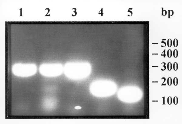 Gel agarose electrophoresis of the polymerase chain reaction amplification products of Trichinella sp. larvae. Lines 1 and 2, larvae in wild boar meat from Camargue, France; line 3, larva from the reference strain for T. pseudospiralis; line 4, larva from the reference strain for T. spiralis; and line 5, larva from the reference strain for T. britovi. Molecular weight markers: 50 base pairs DNA ladder (Pharmacia).