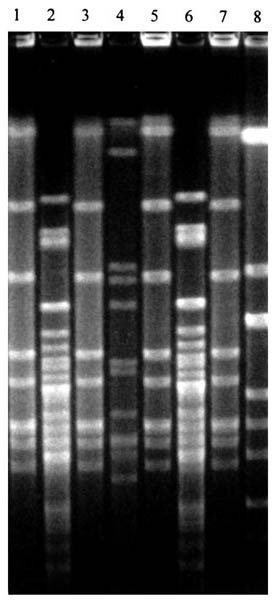 Four distinct Haemophilus influenzae isolates from one child during a sampling period. Lanes 1-8: H. influenzae isolates collected from child no. 32 at the third sampling period.