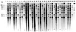 Thumbnail of BstEII rRNA gene profiles of nontoxigenic Corynebacterium diphtheriae from isolates submitted to the Public Health Laboratory Service's Streptococcus and Diphtheria Reference Unit from U.K. residents,* 1995. Lanes 1, 4, 7, 10, 13, 16, 19, 22, 25, 28, 31, and 34 contain lambda HindIII digests as size standard (sizes indicated on left). The remaining tracks show ribotypes A to W: lane 2, 95/13 (A); lane 3, 95/281 (B); lane 5, 95/384 (C); lane 6, 95/358 (D); lane 8, 95/220 (E); lane 9,