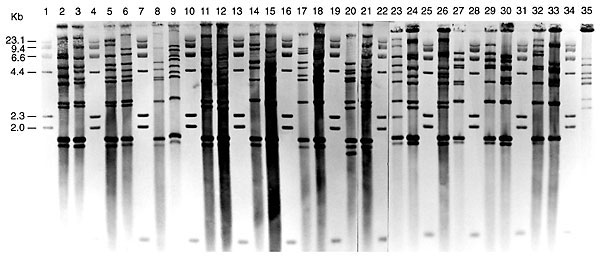 BstEII rRNA gene profiles of nontoxigenic Corynebacterium diphtheriae from isolates submitted to the Public Health Laboratory Service's Streptococcus and Diphtheria Reference Unit from U.K. residents,* 1995. Lanes 1, 4, 7, 10, 13, 16, 19, 22, 25, 28, 31, and 34 contain lambda HindIII digests as size standard (sizes indicated on left). The remaining tracks show ribotypes A to W: lane 2, 95/13 (A); lane 3, 95/281 (B); lane 5, 95/384 (C); lane 6, 95/358 (D); lane 8, 95/220 (E); lane 9, 95/258 (F);
