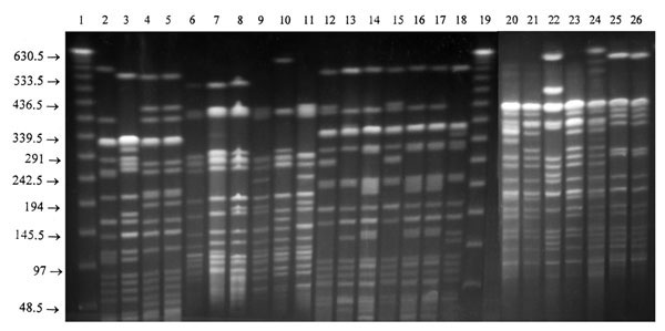 XbaI restriction endonuclease fragment patterns of representative Salmonella Typhi isolates from various countries. Lanes 1 and 19, molecular size standard; Lane 2, B1 from Bangladesh; Lane 3, I1 from India; Lanes 4 and 5, K1 and K2 from Kuwait; Lanes 6, 7, 8, and 9, M1, M2, M3, and M4 from Malaysia; Lanes 10, 11, 12, 13, and 14, Q1, A2, A3, A4, and A5 from Quetta; Lanes 15, 16, 17, and 18, R1, R2, R3, and R4 from Rawalpindi, Pakistan; Lanes 20-24, K1-K5: sensitive S. Typhi from Kenya; and Lanes