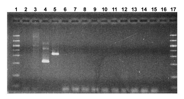 Evaluation of Anthrax Vaccine Adsorbed (AVA) for amplified mycoplasma DNA by gel electrophoresis. Molecular weight markers were run in lanes 1 and 17. Control samples in lanes 2-5 were mycoplasma broth, Hut 78 cell extract, Acholeplasma laidlawii, and Mycoplasma pirum, respectively. The AVA samples were in lanes 6 to 15: Lot FAV048B from Davis Monthan AFB (lane 6), Kansas City MO NRC (lane 7), and Camp Pendleton (lane 8); Lot FAV047 from Fort Detrick (lanes 9 and 11) and Pearl Harbor NMC (lane 10); Lot FAV031 from Fort Worth Base Naval Clinic (lane 12) and the Pentagon Clinic (lane 13); and Lot FAV008 from Davis Monthan AFB (lane 14) and McEntire ANG Station (lane 15). Lane 16 contained water. Bands seen below 100 base pairs are primer multimers.