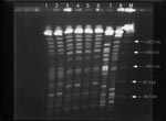 Thumbnail of Pulsed-field gel electrophoresis profiles of XbaI-digested genomic DNAs from eight Klebsiella pneumoniae isolates. Lanes 1 and 2, profiles for isolates A1 and A2 (from patient A); lines 3 to 6, profiles for isolates B1 to B4 (from patient B), respectively; and lanes 7 and 8, isolates of K. pneumoniae from two other patients used as control strains. Lane M, bacteriophage lamdba DNA concatemers (GibcoBRL, Gaithersburg, MD)