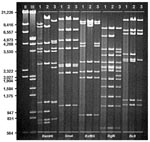 Thumbnail of Restriction profiles of representative human adenovirus (Ad) genome types Ad7b (1), Ad7d2 (2), and Ad7h (3) after digestion with selected enzymes, BamHI, Sma I, BstEII, BglII, and BcII. DNA markers II (λ HindIII) and III (λ HindIII/EcoRI).