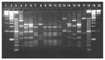 Thumbnail of Restriction profiles obtained after digestion of polymerase chain reaction products from the ITS1 locus with Mse I. lanes 1- 3-, 100-, 50-, and 10-bp ladder molecular weight markers; lanes 4 and 15, bovine genotype 2 isolates; lanes 5, 6, 14, and 16, human genotype 1 isolates including DE340 (lane 14); lanes 7 and 9–12, cervine genotype isolates including MH205 (lane 7), TK320 (lane 10), and DE302 (lane 11); lane 8, Cryptosporidium meleagridis isolate CS33; lanes 13 and 17, other novel genotype isolates such as VF383 (lane 13) and TK348 (lane 17)