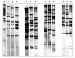 Thumbnail of Twelve BstEII ribotypes identified in 47 Corynebacterium diphtheriae isolates collected in the Russian Federation between 1957 and 1987. The figure is composed of ribotype gels exemplifying the different patterns observed in the strain collection. Lane M, molecular weight marker; lane 1, ribotype M11e; lane 2, M11f; lane 3, M13a; lane 4, M7a; lane 5, unique; lane 6, G4; lane 7, unique; lane 8, M11g; lane 9, M3; lane 10, M1b; lane 11, M6; lane 12, M13b.