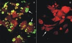 Thumbnail of Immunofluorescence assay (IFA) of Vero E6 cells infected with Chilean hantavirus CHI-7913 isolate. A, IFA with seropositive human sera from a Chilean HPS patient; arrow shows infected Vero E6 cells expressing hantavirus antigens. B, IFA with seronegative human sera from uninfected control; arrow shows the negative IFA of Vero E6 cells infected with the CHI-7913 isolate.