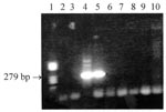 Thumbnail of Results of the nested polymerase chain reaction (PCR) assay performed on the serum specimens from both patients and their dogs. Lane 1: standard DNA size marker V (Boehringer, Mannheim, Germany); lanes 2 and 3: serum #1 from man; lanes 4 and 5: serum #1 from woman; lanes 6 and 7: serum from dog #1; lanes 8 and 9: serum from dog #2; lane #10: negative control; lanes 2, 4, 6, and 8: pure DNA; and lanes 3, 5, 7, and 9: DNA diluted 1:10 in deionized water.