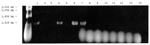 Thumbnail of Detection of the Rickettsia specific 17-kDa gene by polymerase chain reaction amplification in DNA extracted from ticks and fleas. The vectors were first placed in 1.5-mL microcentrifuge tubes containing 200 µL of 10 mM phosphate-buffered saline, pH 7.4, and were crushed with a micropestle. The suspensions were lysed in 0.5% sodium dodecyl sulfate and incubated with 100 µg/mL proteinase K at 37°C for 1 hour in the case of fleas or overnight in the case of ticks. The lysed suspensions were extracted twice with an equal volume of phenolchloroform, followed by a single chloroform extraction. The extracted DNA was amplified with primer 1 (5′-GCTCTTGCAACTTCTATGTT-3′) and primer 2 (5′-CATTGTTCGTCAGGTTGGCA-3′) as described by Webb et al.  (10) for amplification of a 434-bp fragment from the rickettsial 17-kDa protein gene. PCR was performed at 30 cycles for 1 minute at 94°C, 5 minutes at 48°C, and 2 minutes at 72°C. The PCR products were then separated by electrophoresis in 1% agarose gel and stained with ethidium bromide. Lanes 1-3: DNA from cat fleas, Lanes 4-6: DNA from dog fleas, Lane 7: 17- kDa gene Rickettsia felis DNA (Positive Control), Lanes 8-14: DNA from ticks.