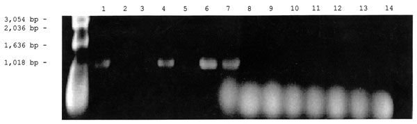 Detection of the Rickettsia specific 17-kDa gene by polymerase chain reaction amplification in DNA extracted from ticks and fleas. The vectors were first placed in 1.5-mL microcentrifuge tubes containing 200 µL of 10 mM phosphate-buffered saline, pH 7.4, and were crushed with a micropestle. The suspensions were lysed in 0.5% sodium dodecyl sulfate and incubated with 100 µg/mL proteinase K at 37°C for 1 hour in the case of fleas or overnight in the case of ticks. The lysed suspensions were extracted twice with an equal volume of phenolchloroform, followed by a single chloroform extraction. The extracted DNA was amplified with primer 1 (5′-GCTCTTGCAACTTCTATGTT-3′) and primer 2 (5′-CATTGTTCGTCAGGTTGGCA-3′) as described by Webb et al.  (10) for amplification of a 434-bp fragment from the rickettsial 17-kDa protein gene. PCR was performed at 30 cycles for 1 minute at 94°C, 5 minutes at 48°C, and 2 minutes at 72°C. The PCR products were then separated by electrophoresis in 1% agarose gel and stained with ethidium bromide. Lanes 1-3: DNA from cat fleas, Lanes 4-6: DNA from dog fleas, Lane 7: 17- kDa gene Rickettsia felis DNA (Positive Control), Lanes 8-14: DNA from ticks.