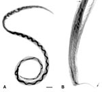Thumbnail of Adult Angiostrongylus cantonensis recovered from rat lungs. A. Adult female worm with characteristic barber-pole appearance (anterior end of worm is to the top). Scale bar = 1 mm. B. Tail of adult male, showing copulatory bursa and long spicules (arrows). Scale bar = 85 μm.