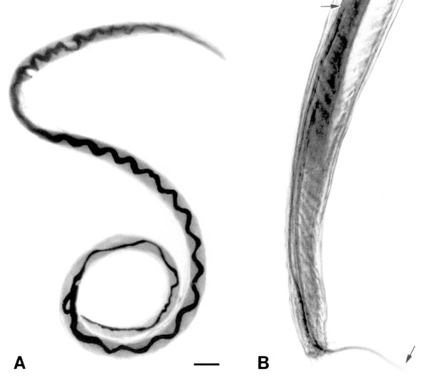 Adult Angiostrongylus cantonensis recovered from rat lungs. A. Adult female worm with characteristic barber-pole appearance (anterior end of worm is to the top). Scale bar = 1 mm. B. Tail of adult male, showing copulatory bursa and long spicules (arrows). Scale bar = 85 μm.