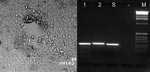 Thumbnail of Left: cytopathic effect in Vero cells consisting of a plaque and rounding of the cells after homogenized altered mucosal membrane of the marmoset was added to the cell culture. Right: type-specific polymerase chain reaction (PCR). Lanes 1 and 2 show fragments of 229-bp DNA amplified from Human herpesvirus 1 (HHV-1) and 241 bp from HHV-2 control strains, respectively. Lane S shows an HHV-1–specific PCR product amplified from an oral mucosa specimen of the marmoset; no product was obtained from supernatants of uninfected cell culture (lane -). Lane M, 1 kb DNA Ladder (GIBCO/BRL,Grand Island, NY).