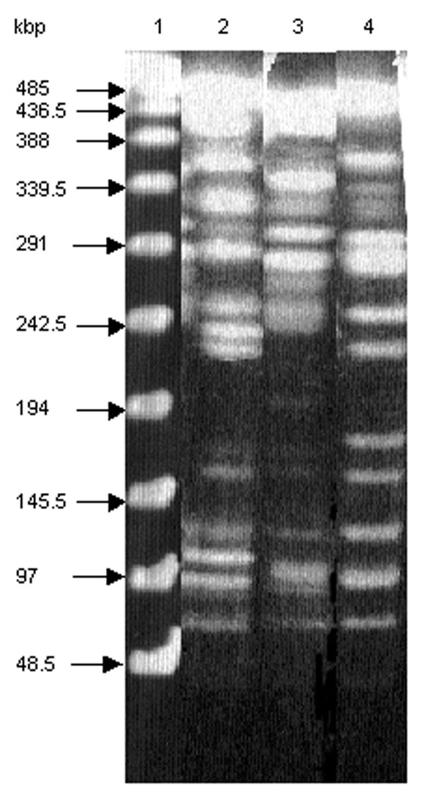 Macrorestriction analysis by pulsed-field gel electrophoresis of genomic DNAs cut by XbaI of S. enterica serotype Typhimurium DT 104 strain BN9181 (lane 2), serotype Agona strain 959SA97 (lane 3), and the serotype Paratyphi B strain (lane 4). Lane 1: DNA ladder.