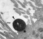 Thumbnail of Attaching and effacing lesion showing effacement of microvilli (mv) and pedestal (star) with adherent enteropathogenic Escherichia coli (EPEC) (arrow). Reprinted from reference 2, with permission of the director of American Society of Microbiology Journals.
