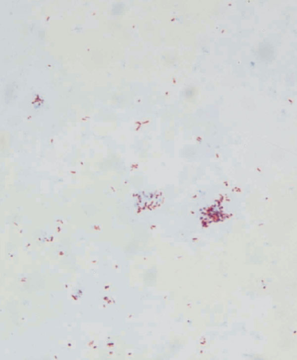 Ziehl-Neelsen–stained micrograph of Mycobacterium avium subsp. paratuberculosis colonies growing on mycobactin-supplemented Middlebrook agar.