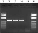 Thumbnail of Agarose gel electrophoresis of amplified IS900 fragments. Lanes 1 and 6: molecular weight marker (2176, 1766, 1230, 1033, 653, 517, 453, 394, 298, 234–220, 154 bp); lanes 2 and 3: two patient samples; lane 4: positive control (Mycobacterium avium subsp. paratuberculosis type strain); and lane 5: negative control (Mycobacterium avium strain).