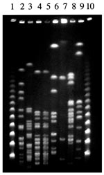 Thumbnail of NotI restriction patterns of Leptospira strains obtained with the Bio-Rad apparatus (Richmond, CA) with a pulse time ramped from 5 to 90 s for 36 h. The lanes contain lambda concatemers (lanes 1 and 10) and DNA from isolates: patient strain (lane 2); L. fainei hurstbridge, strain But 6 (lane 3); L. inadai Lyme, strain 10 (lane 4); L. inadai biflexa, strain LT430 (lane 5); L. biflexa patoc, strain Patoc I (lane 6); L. meyeri semaranga, strain VS173 (lane 7); L. kirschneri grippotyphosa, strain MoskvaV (lane 8); and L. interrogans icterohaemorrhagiae, strain Verdun (lane 9).