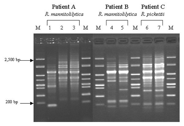 Randomly amplified polymorphic DNA analysis of serial isolates from three patients. M: molecular weight marker; lanes 1, 2, and 3: serial Ralstonia mannitolilytica isolates from patient A in chronological order; lanes 4 and 5: serial R. mannitolilytica isolates from patient B in chronological order; and lanes 6 and 7: serial R. pickettii isolates from patient C in chronological order.