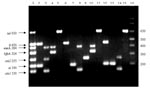 Thumbnail of Polymerase chain reaction (PCR) products of each locus. Lane 1: sizes of the seven PCR products of each locus in base pairs, obtained when using a DNA mix of the four reference strains and the primers mix. PCR products obtained by using DNA of enterotoxigenic Escherichia coli, Shiga-toxin–producing E. coli, enteropathogenic E. coli, and enteroinvasive E. coli (lanes 2–5, respectively). Lane 6–11: PCR products obtained when using DNA of patients’ isolates and the primers mix. Lanes 1