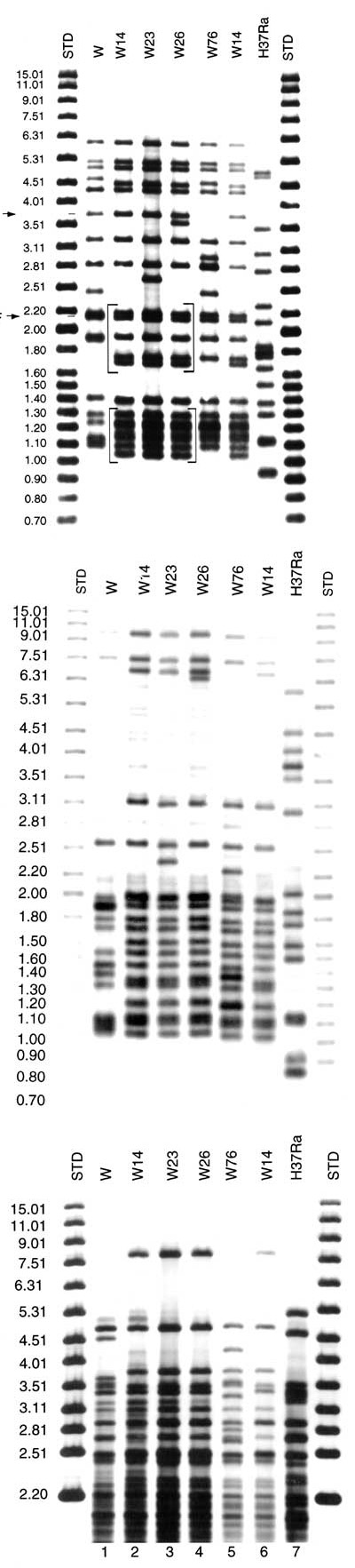 Southern blot hybridization of Mycobacterium tuberculosis isolates. A) IS6110-3' was used as a hybridization probe. The bracketed pattern motives regions are characteristic of the W14 family. A1 and NTF denote the bands corresponding to the IS6110 insertions in the dnaA-dnaN region and the NTF locus, respectively. Lanes 1 and 9 are standard markers; lane 2: W-MDR from New York City (W index strain); lane 3, 4, 5 and 7: members of the W14 family; lane 6: W76 and lane 8: laboratory control strain 
