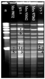 Thumbnail of Pulsed-field gel electrophoresis analysis of chromosomal DNA (ethidium bromide staining) of 104 strains isolated in Africa. DNA macrorestriction fragments were generated with BglII; 103 out of 104 strains showed closely related profiles. ST-5 pattern was the first pattern found in Africa and the most frequently isolated from 1988 to 1996. The second pattern was the ST-7 pattern, attributable to strains isolated more recently in Algeria, Cameroon, Sudan, Chad, and Niger. ST-7 pattern