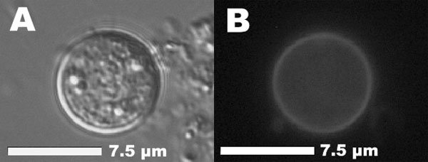Unsporulated oocyst of Cyclospora cayetanensis in an unstained stool preparation. A) Differential interference contrast. B) Same oocyst with typical blue autofluorescence (Filter sets: 365-nm excitation, 395-nm dichroic mirror, 420-nm suppression).