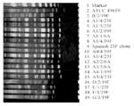 Thumbnail of Pulsed-field gel electrophoresis (PFGE) patterns of SmaI-digested genomic DNA of Streptococcus pneumoniae isolates. Seven distinct patterns, including A and its subtypes (A0 to A5) and B to G, are shown. Labels indicate the PFGE pattern, hospital source, and serotype. Lane 1: molecular weight markers; lane 2: S. pneumoniae ATCC 49619; lanes 3 to 8: ciprofloxacin-resistant isolates; lane 9: Spanish 23F clone (ATCC 700669); lanes 10-19: ciprofloxacin-sensitive isolates.