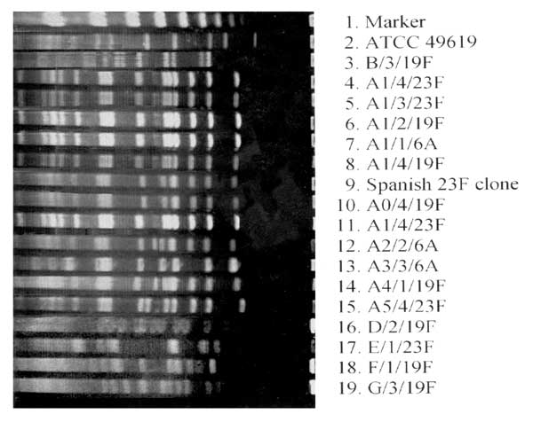 Pulsed-field gel electrophoresis (PFGE) patterns of SmaI-digested genomic DNA of Streptococcus pneumoniae isolates. Seven distinct patterns, including A and its subtypes (A0 to A5) and B to G, are shown. Labels indicate the PFGE pattern, hospital source, and serotype. Lane 1: molecular weight markers; lane 2: S. pneumoniae ATCC 49619; lanes 3 to 8: ciprofloxacin-resistant isolates; lane 9: Spanish 23F clone (ATCC 700669); lanes 10-19: ciprofloxacin-sensitive isolates.
