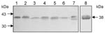 Thumbnail of Identification of the 38-kDa flagellin protein SMFliC in clinical isolates of Stenotrophomonas maltophilia. Lane 1, SMDP14; lane 2, SMDP275; lane 3, SMHC176; lane 4, SMHC181; lane 5, SMDP315; lane 6, SMDP314; and lane 7, SMHC179. Lane 8, the purified SMFliC, was used as positive control. The immunoblot shows the presence of the 38-kDa flagellin protein in all the isolates. Doublet bands were seen in some of the isolates. Molecular weight standards and the 38-kDa flagellin protein are indicated by arrows.