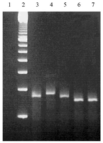 Ethidium bromide stained 3% molecular screening agarose gel containing Bordetella pertussis DNA amplified with primers QH8F´ and QH2R. Lanes: 1, negative control including all reagents but no template DNA; 2, 100-bp ladder; 3, B. pertussis strain 1772 of type prn1 (260 bp); 4, Bordetella pertussis clinical isolate of type prn2 (275 bp); 5, B. pertussis clinical isolate of type prn3 (260 bp); 6, B. pertussis clinical isolate of type prn4 (245 bp); and 7, B. pertussis type prn5 (245 bp).
