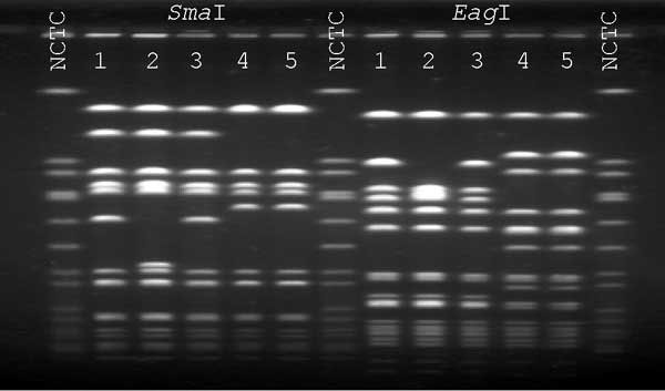 Pulsed-field gel electrophoresis profiles of SmaI- and EagI-Digested DNA. NCTC, National Collection of Type Cultures 8325 control. Lane 1, patient's oxacillin-resistant vancomycin-intermediate Staphylococcus aureus (VISA); lane 2, patient's oxacillin-susceptible VISA; lane 3, patient's oxacillin-resistant S. aureus (ORSA, vancomycin MIC = 2 µg/mL) from anterior nares; lanes 4 and 5, isolates of ORSA (vancomycin MIC = 2 µg/mL) from the health-care worker's anterior nares.