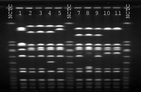 Pulsed-field gel electrophoresis profiles of SmaI digested DNA. NCTC, National Collection of Type Cultures 8325 control. Lane 1, vancomycin-intermediate Staphylococcus aureus (VISA) isolate from Japan, otherwise designated Mu50; lane 2, VISA isolate from Michigan (7); lane 3, VISA isolate from New Jersey (7); Lane 4, VISA isolate from New York (1); lane 5, VISA isolate from Illinois (3); lane 7, patient's oxacillin-resistant VISA; lane 8, patient's oxacillin-susceptible VISA; lane 9 patient's ox